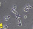 Disaster declaration after brain-eating amoeba found in water l GMA