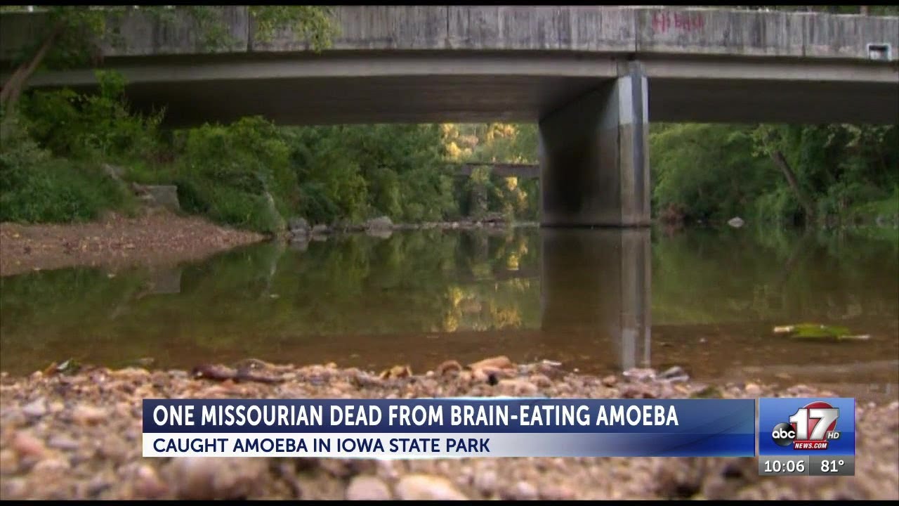 Missouri Swimmer Dies of Rare Brain-Eating Amoeba | ABC News