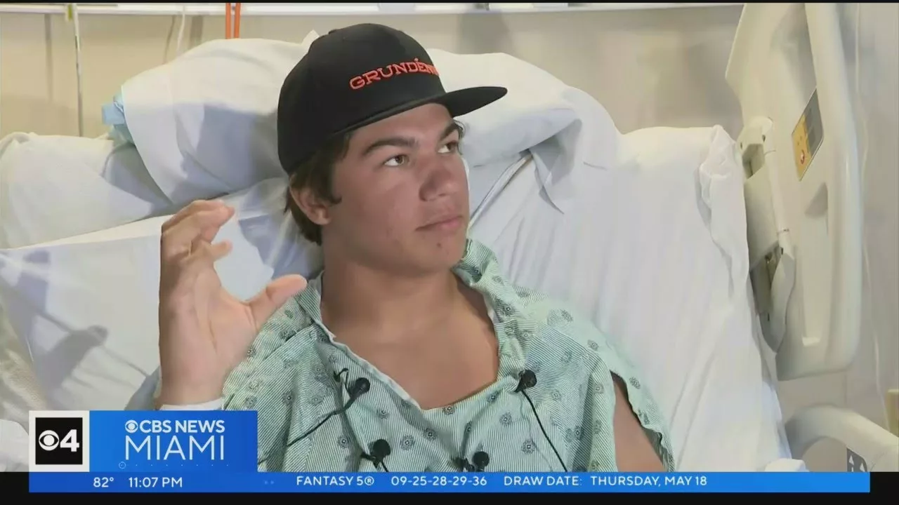 Man Bitten by Bull Shark in Keys Talks About Ordeal | CBS Miami