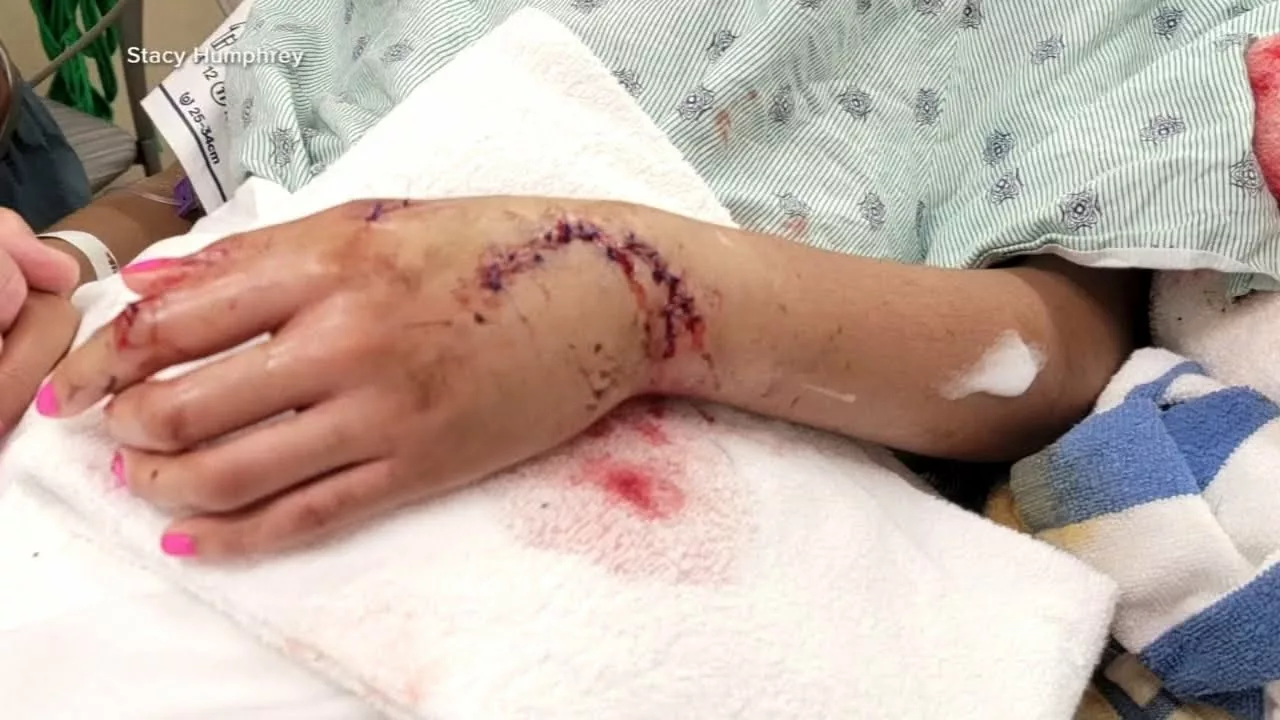 3 Swimmers Attacked By Sharks Off Florida Panhandle | ABC 7 Chicago